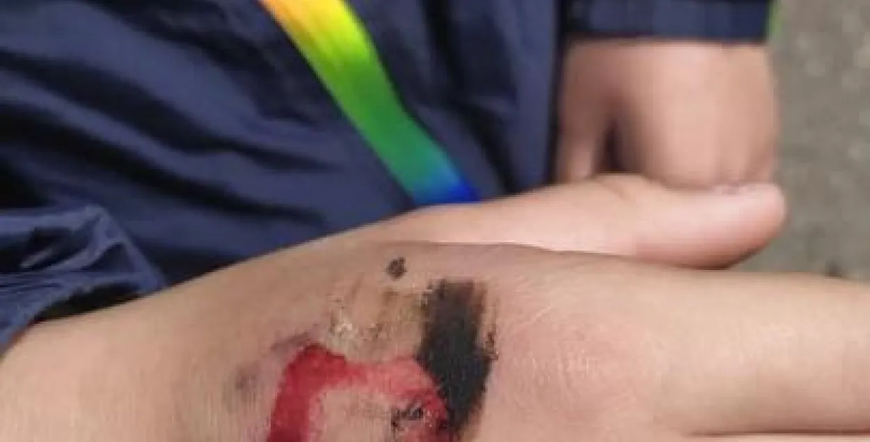 В Гродно мальчик получил травму руки во время выступления военнослужащих 9 мая / TUT.by