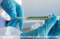 Беларусь уже имеет небольшой запас тестов на коронавирус / БЕЛТА